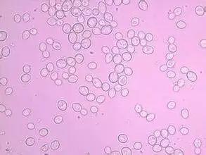 精酿啤酒之酿造原料篇-酵母 精酿啤酒之酿造原料篇-酵母