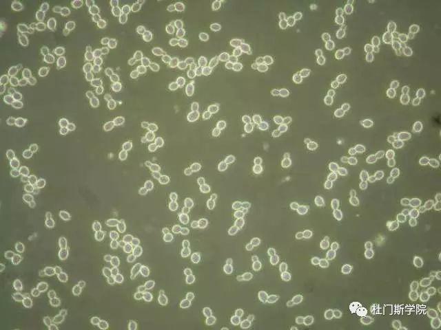 酵母和啤酒发酵产生的风味 酵母和啤酒发酵产生的风味