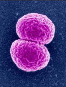 干货课堂|啤酒生产卫生危害 干货课堂|啤酒生产卫生危害