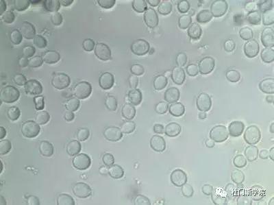 酿酒师的必修课——探索酵母的神奇世界 酿酒师的必修课——探索酵母的神奇世界