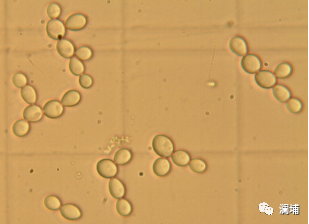 锦囊|酵母的回收和保存 锦囊|酵母的回收和保存