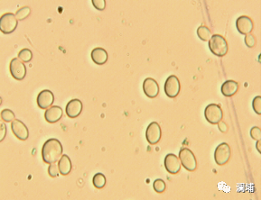 锦囊|酵母的回收和保存 锦囊|酵母的回收和保存