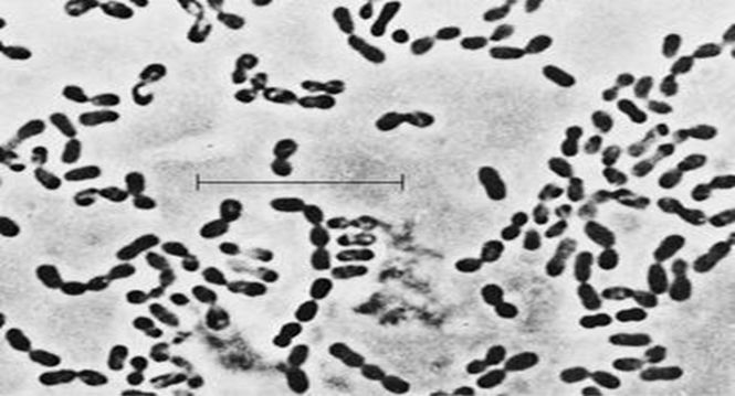 干货课堂|啤酒生产卫生危害 干货课堂|啤酒生产卫生危害