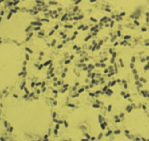 干货课堂|啤酒生产卫生危害 干货课堂|啤酒生产卫生危害