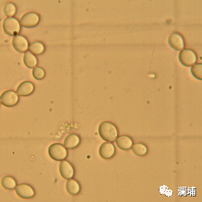知识|上面酵母与下面酵母 知识|上面酵母与下面酵母
