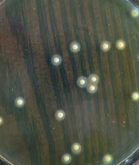 干货课堂|啤酒生产卫生危害 干货课堂|啤酒生产卫生危害