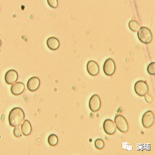 知识|上面酵母与下面酵母 知识|上面酵母与下面酵母