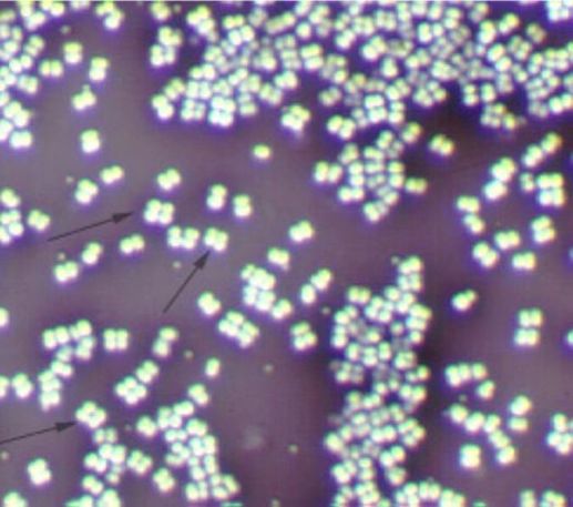 干货课堂|啤酒生产卫生危害 干货课堂|啤酒生产卫生危害