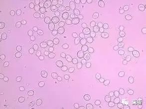 知识篇|啤酒原料酵母 知识篇|啤酒原料酵母