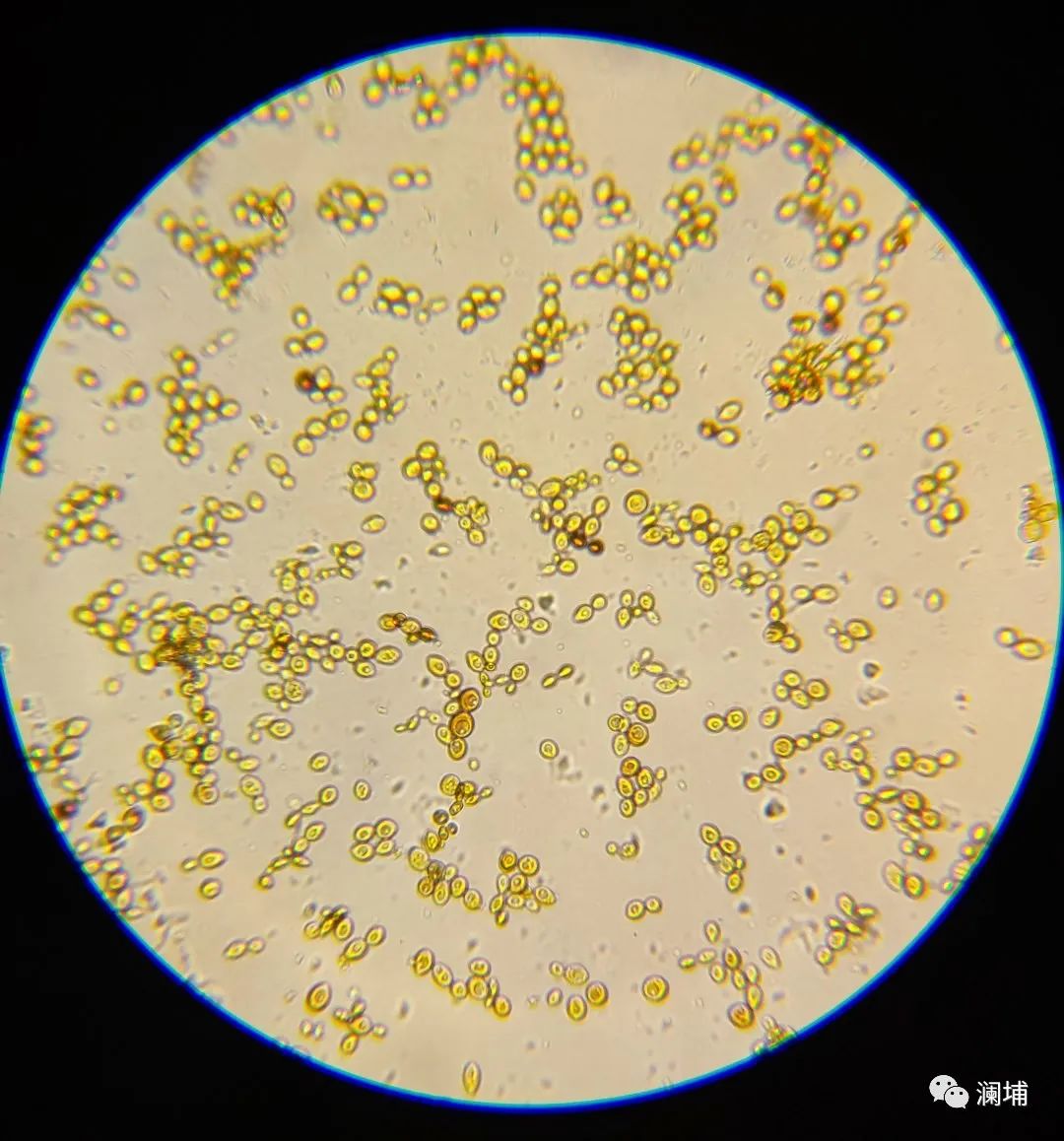 酵母专题课——提升风味,节省成本 酵母专题课——提升风味,节省成本