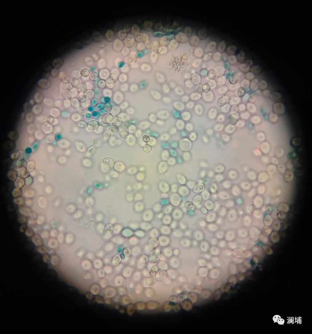 酵母专题课——提升风味,节省成本 酵母专题课——提升风味,节省成本